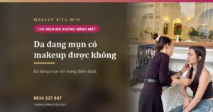 Da đang mụn makeup được không? Che mụn đỏ mà không làm mặt nặng thêm