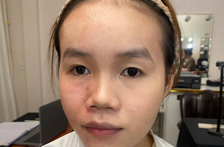 Mặt mộc đẹp tự nhiên trước khi trang điểm, da còn vài vết thâm